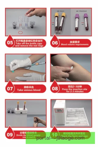 反兴奋剂检测审计要点，样本链条闭环才能确保公正